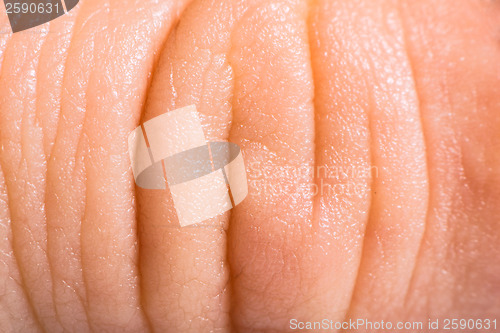 Image of Close up human skin. Macro epidermis 