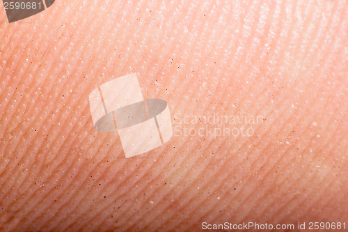 Image of Close up human skin. Macro epidermis 