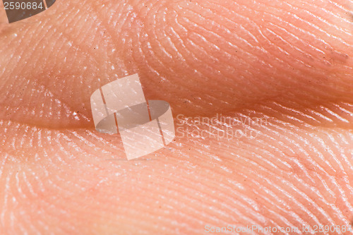 Image of Close up human skin. Macro epidermis 