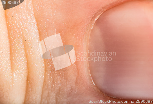 Image of Close up human skin and claw. Macro epidermis 