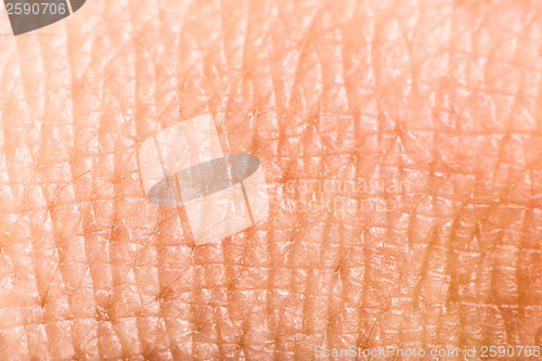 Image of Close up human skin. Macro epidermis 