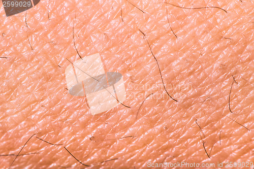 Image of Texture of human skin