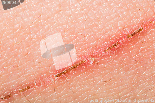 Image of Texture of human skin and scratch
