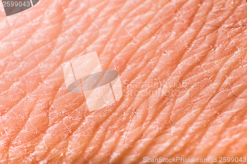 Image of Texture of human skin