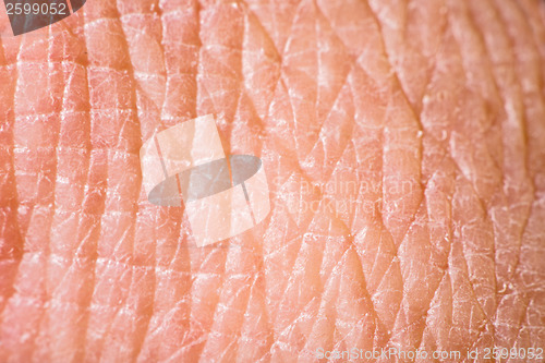 Image of Texture of human skin