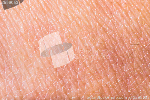 Image of Texture of human skin
