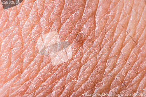 Image of Texture of human skin