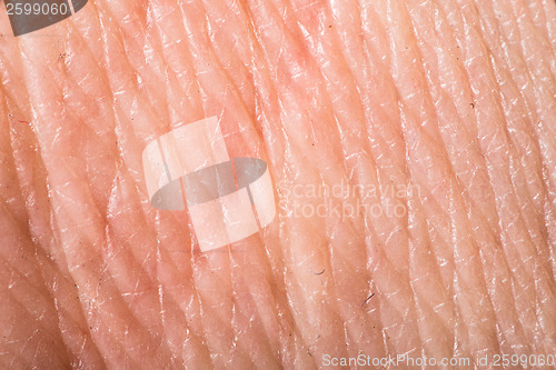 Image of Texture of human skin