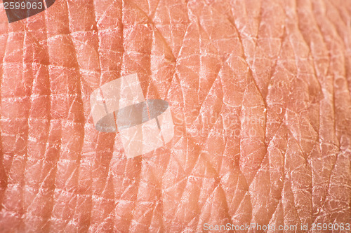Image of Texture of human skin
