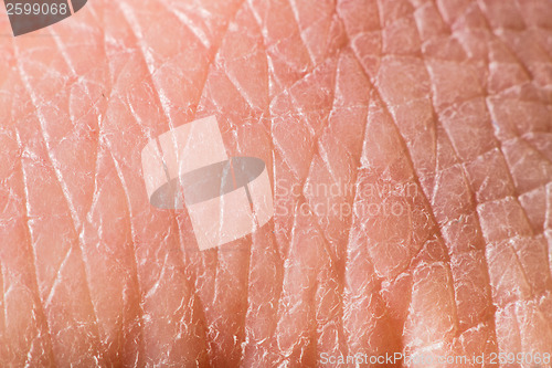 Image of Texture of human skin