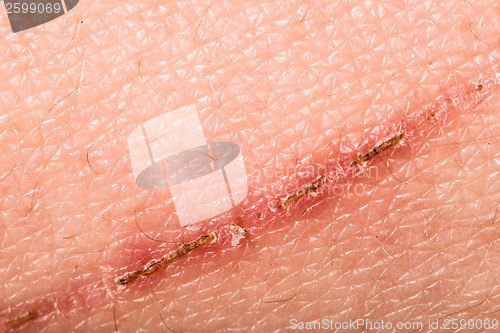 Image of Texture of human skin and scratch