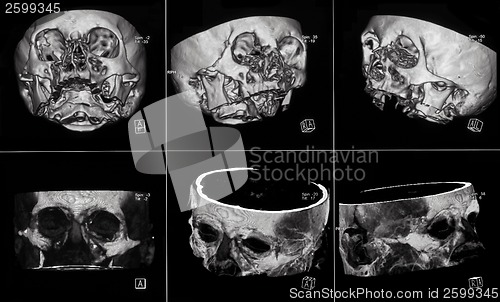 Image of MRIs