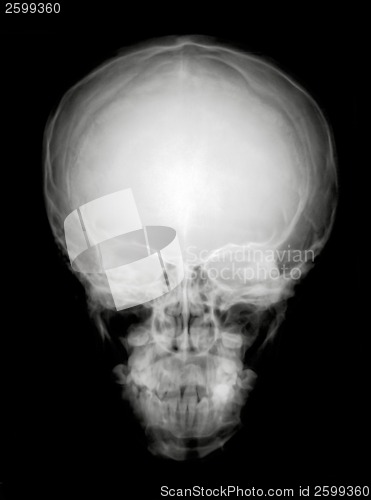 Image of Head from front
