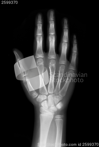 Image of Right hand