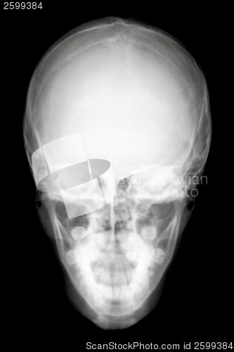 Image of Front Face