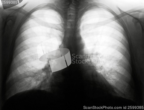 Image of Thorax