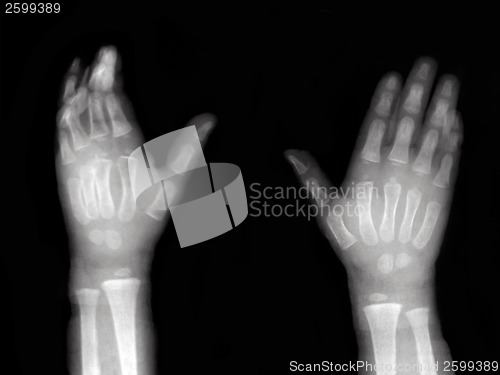 Image of Hands