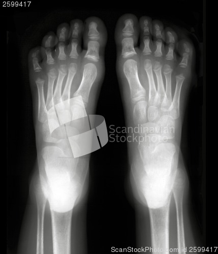 Image of Foot