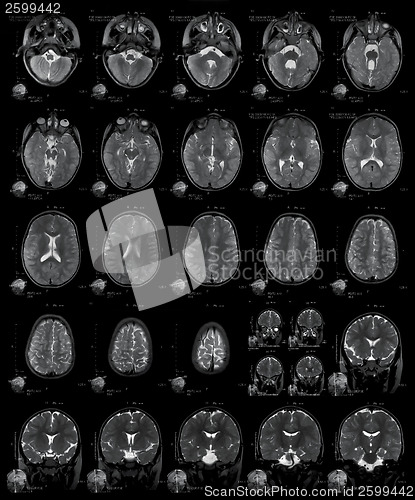 Image of X-ray