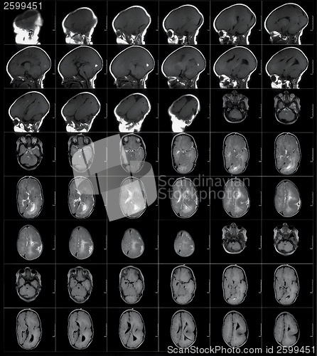 Image of MRI