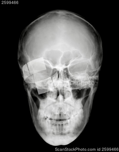Image of FrontHead