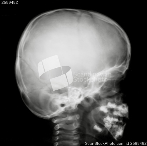Image of Human head