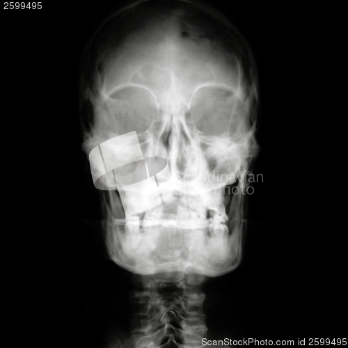 Image of X-ray head