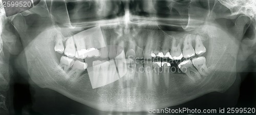 Image of Xray mouth