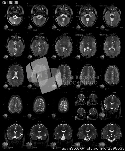 Image of X-ray