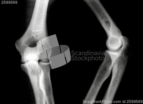 Image of Knees