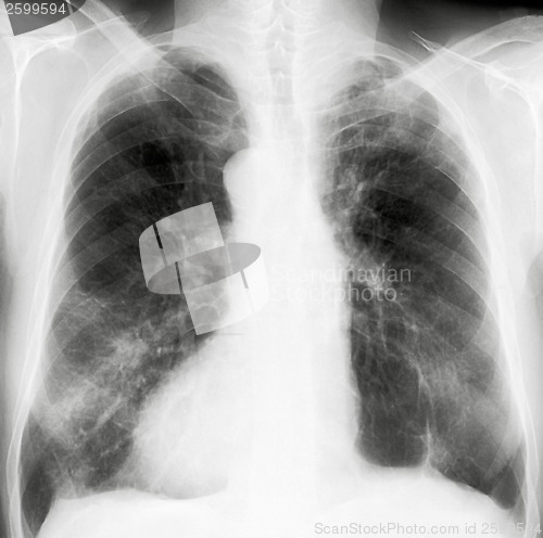 Image of X-Ray