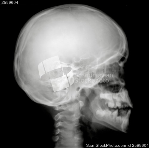 Image of X-Ray Profile