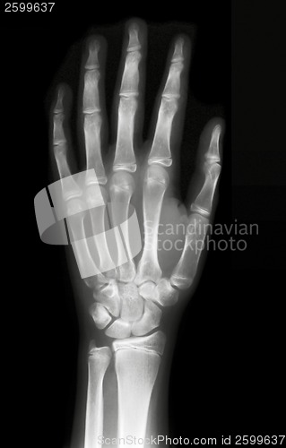 Image of Left hand