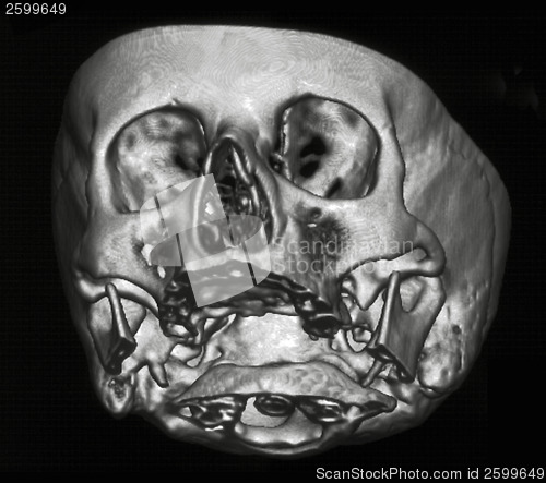 Image of MRI