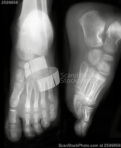 Image of Human foots