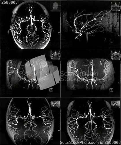 Image of MRI scan