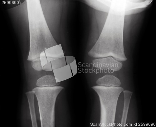 Image of Knees