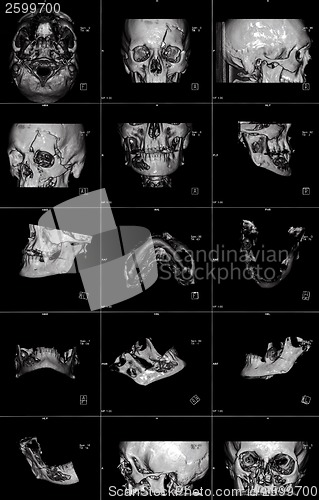 Image of MRI of head