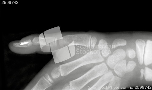 Image of Forefinger