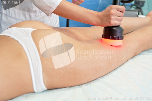 Image of procedure