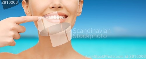 Image of beautiful woman pointing to teeth