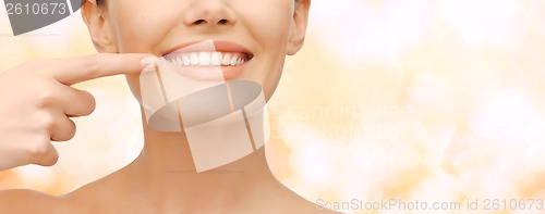 Image of beautiful woman pointing to teeth