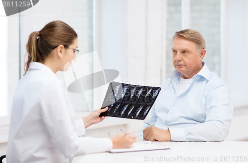 Image of female doctor with old man looking at x-ray