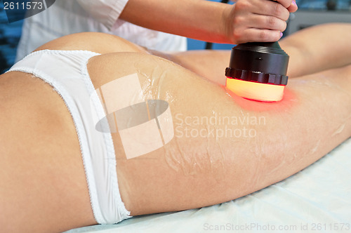 Image of procedure