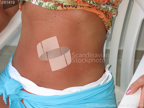 Image of Tummy with a tan