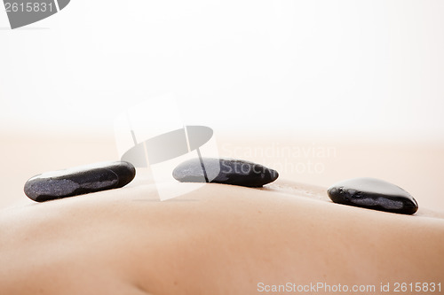 Image of Spa treatment