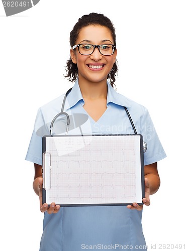 Image of female doctor in eyeglasses with cardiogram