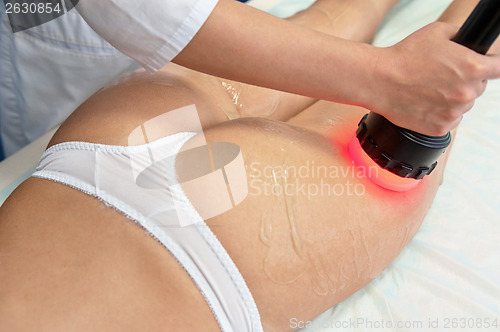 Image of procedure