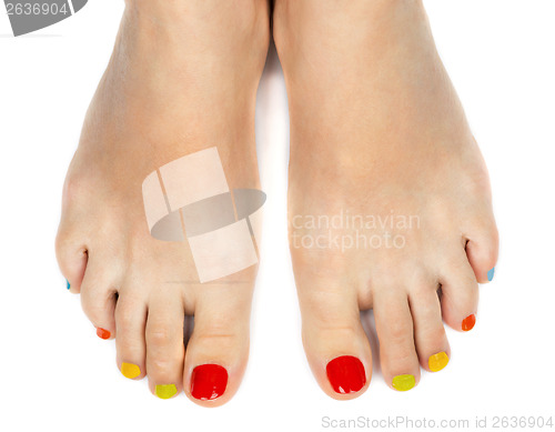 Image of Female feet with a pedicure color