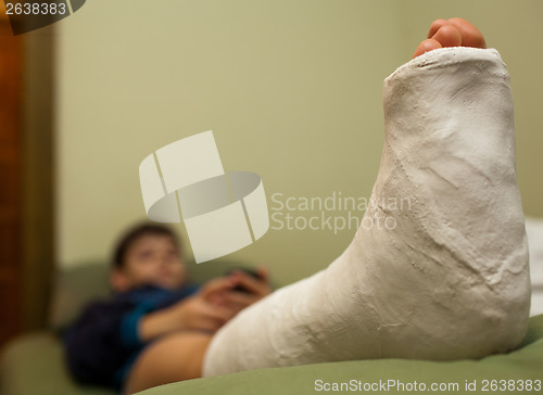 Image of Leg in plaster